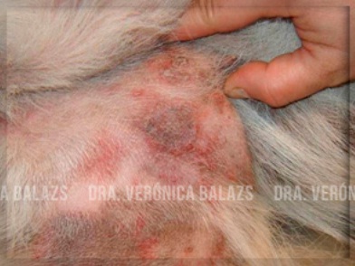 Lesión típica de foliculitis superficial: máculas de hiperpigmentación variable, con anillos eritematosos en los bordes de los collaretes