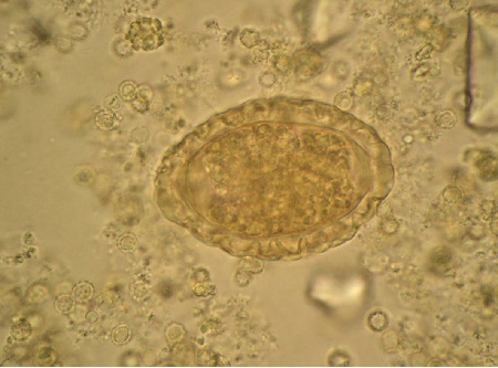 FORO UNO Fig nº 1. Huevo de Dioctophyma renale. 400X