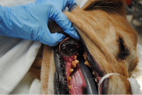 Melanoma oral en la mucosa de la comisura labial