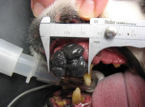 Melanoma oral